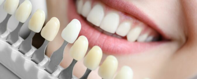 Badanie rynku wspierające rozwój produktu z segmentu materiałów dentystycznych