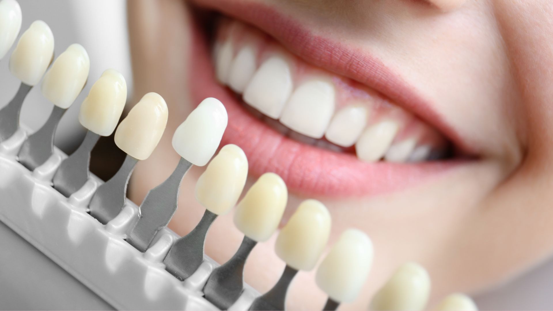 Badanie rynku dla producenta materiałów dentystycznych. 