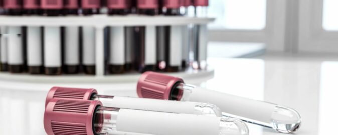 Badanie i analiza rynku diagnostyki laboratoryjnej